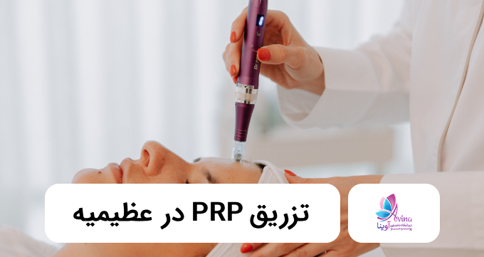 تزریق PRP در عظیمیه