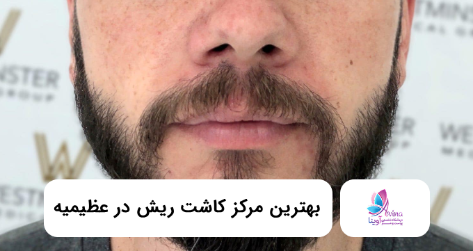بهترین مرکز کاشت ریش در عظیمیه