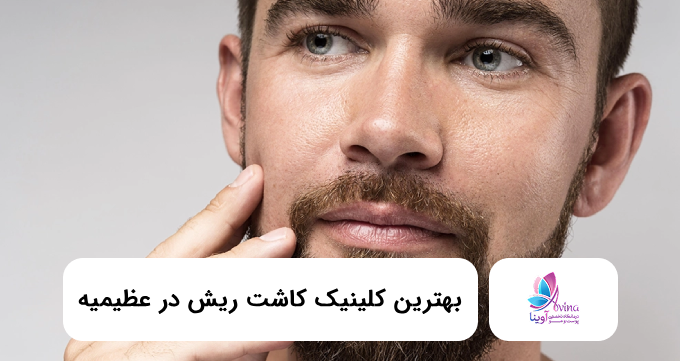بهترین کلینیک کاشت ریش در عظیمیه