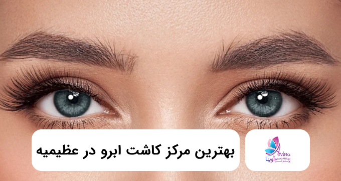 بهترین مرکز کاشت ابرو در عظیمیه ✅【سال۱۴۰۵】