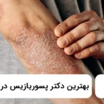 بهترین دکتر پسوریازیس در عظیمیه ✅【سال۱۴۰۵】