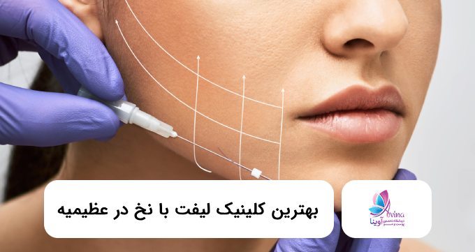 بهترین کلینیک لیفت با نخ در عظیمیه