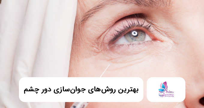 بهترین روش جوانسازی دور چشم ✅【سال1405】❤️