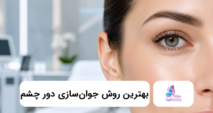 بهترین روش جوانسازی دور چشم ✅【سال1405】❤️