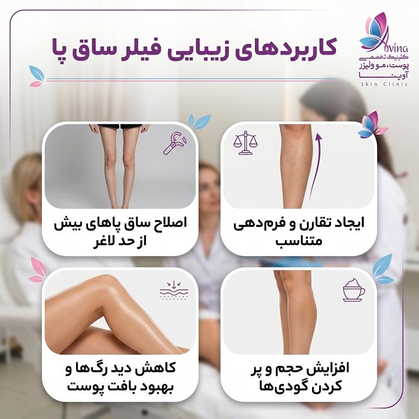 فیلر ساق پا و کاربردهای زیبایی آن