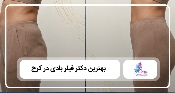 بهترین دکتر فیلر بادی در کرج