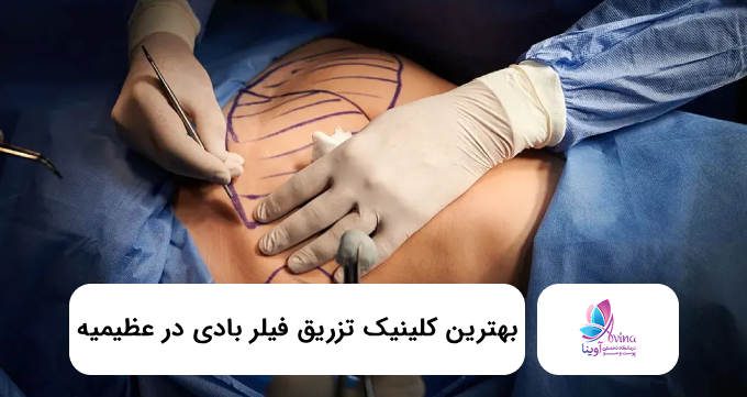بهترین کلینیک تزریق فیلر بادی در عظیمیه