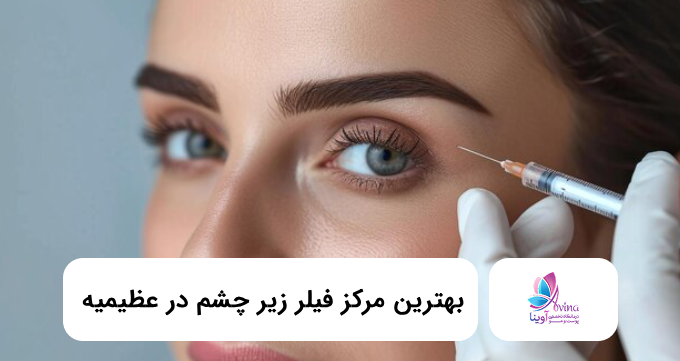 بهترین مرکز فیلر زیر چشم در عظیمیه